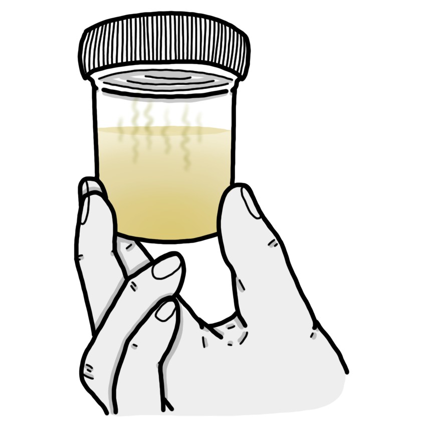 Cloudy and/or foul-smelling urine
