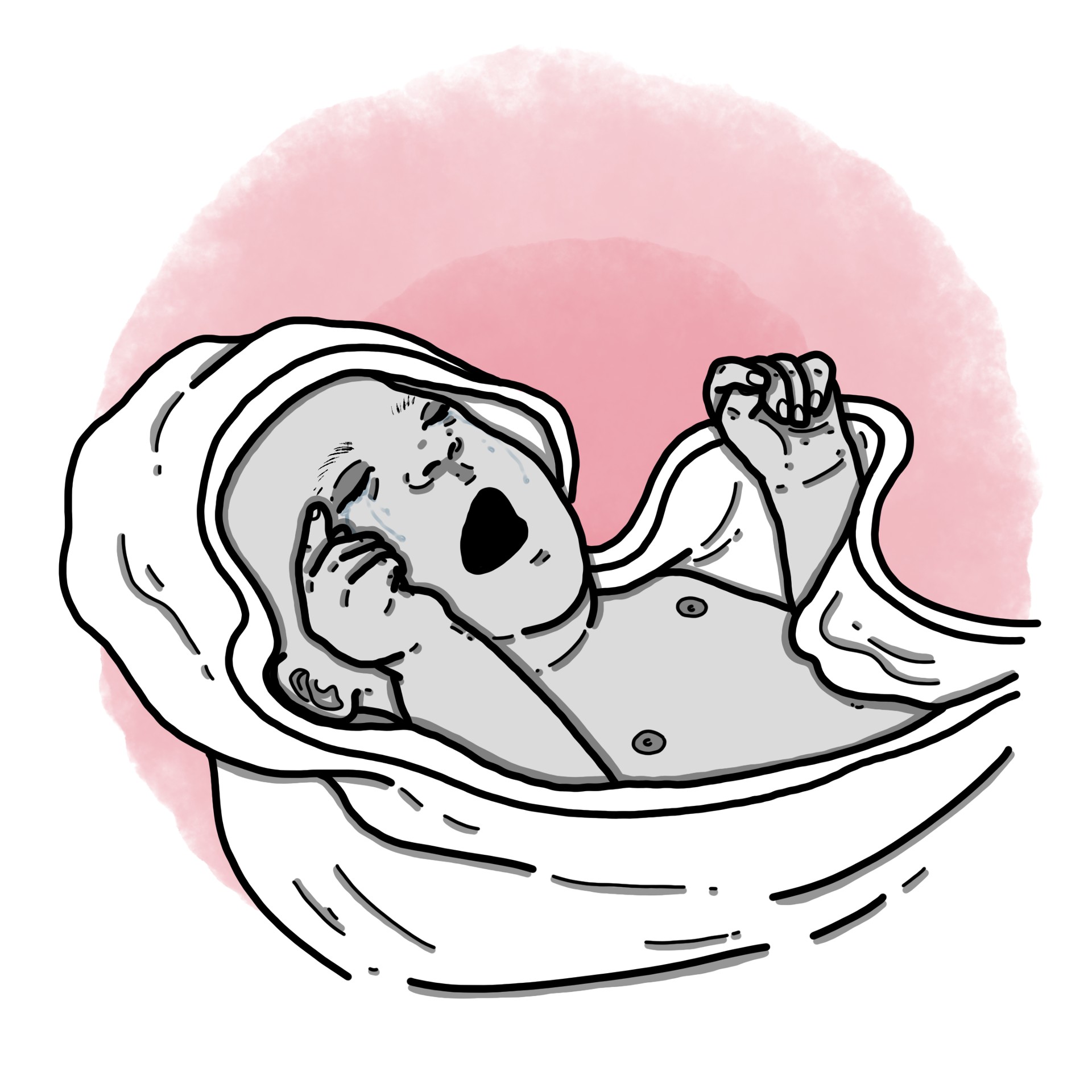 Baby colic (Paediatrics)