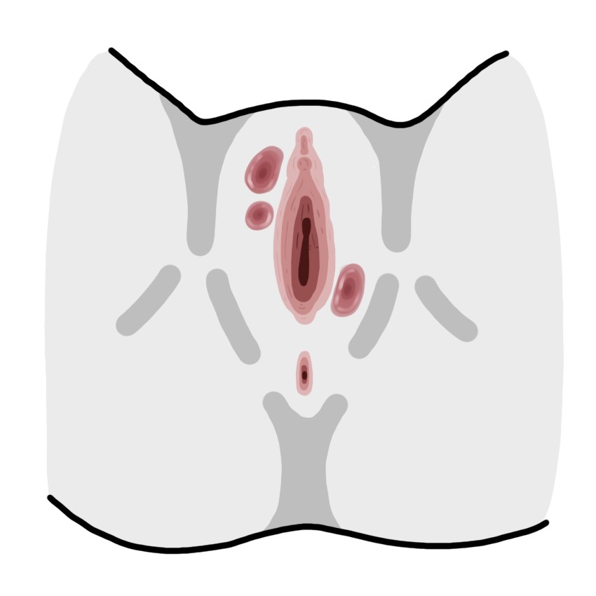 Painful red pimples on vulva