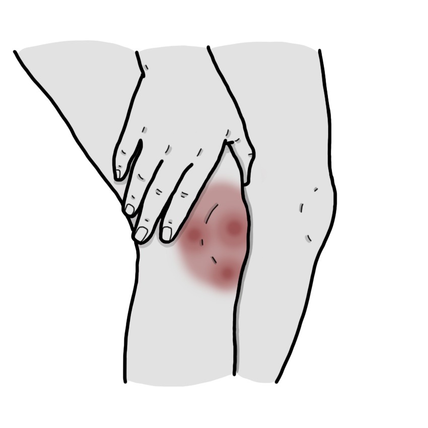 膝頭に痛み