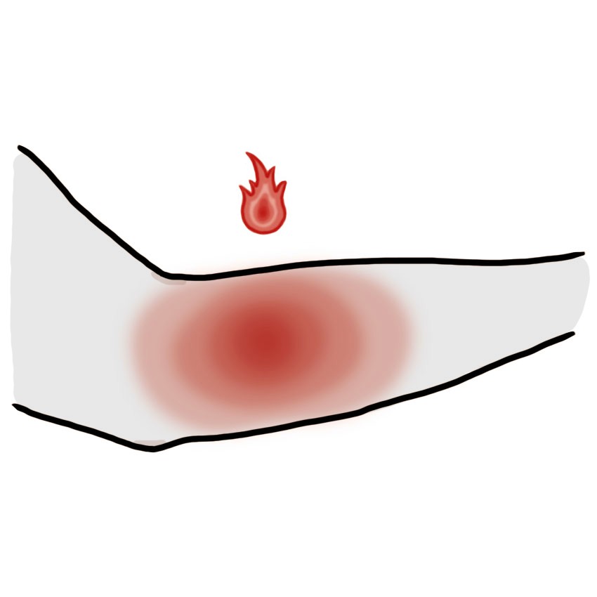 Sensación de ardor en la piel