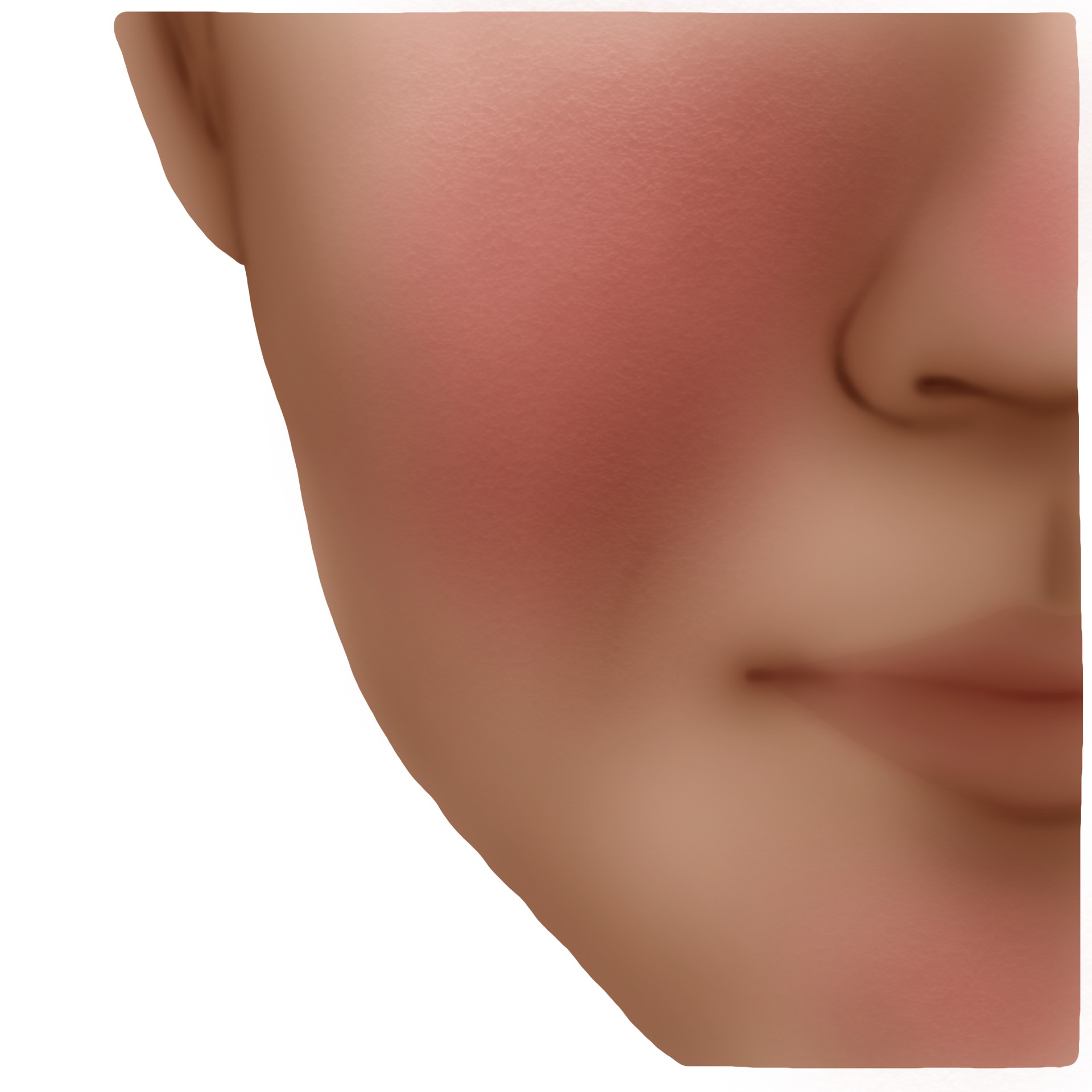 Ροδόχρους νόσος