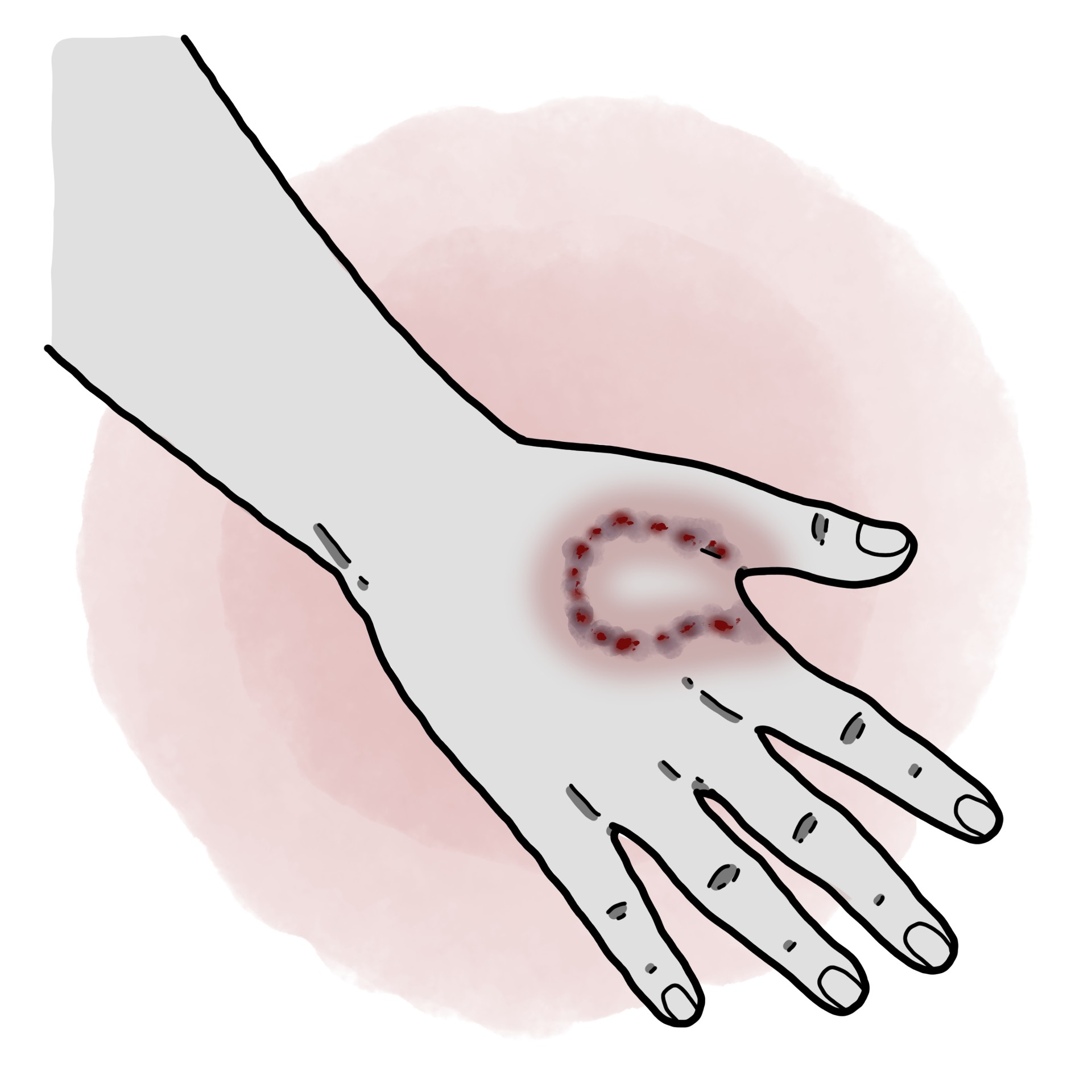 Mammalian animal bite