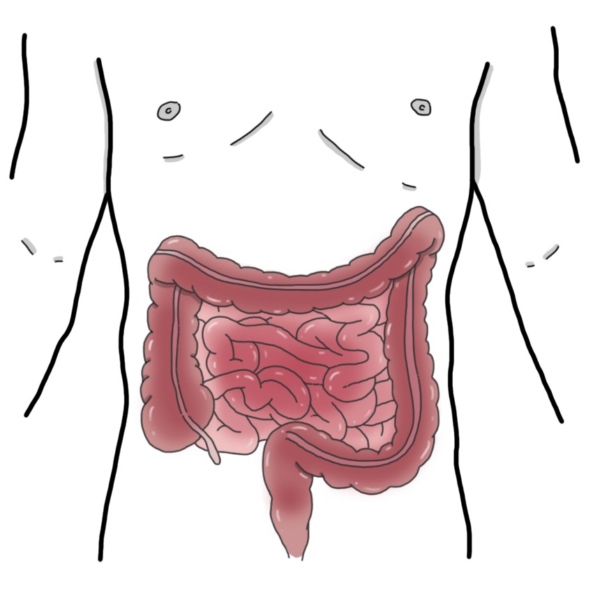 Irritable bowel syndrome