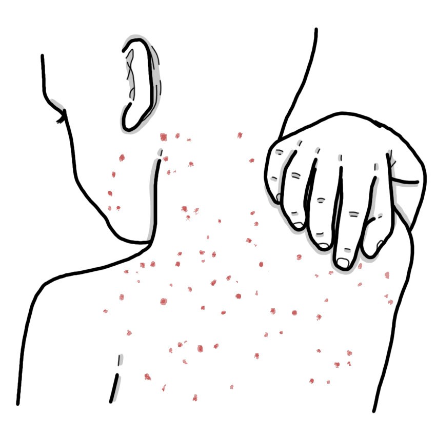 Rubella (Paediatrics)