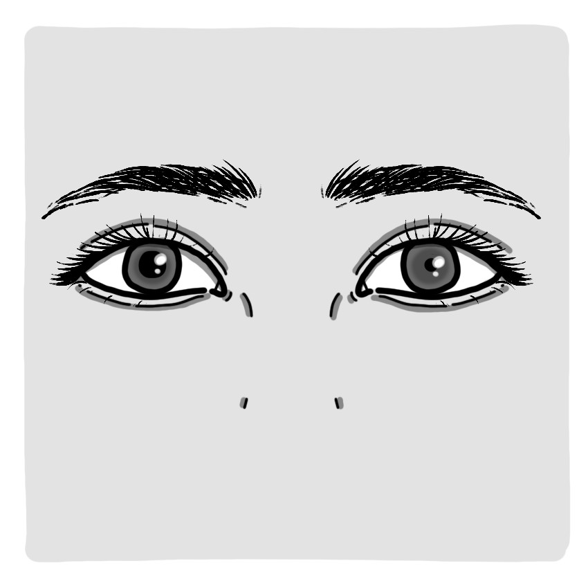 Anisocoria