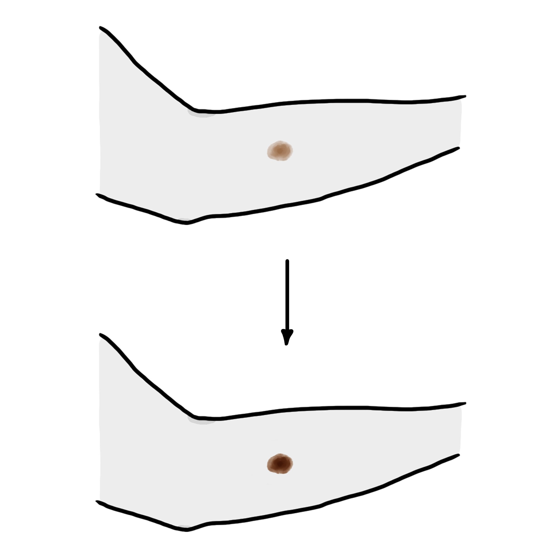 Muttermal ist dunkler geworden